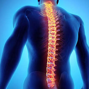 Precision Spinal Implant – Remak Ortho Manufacturing